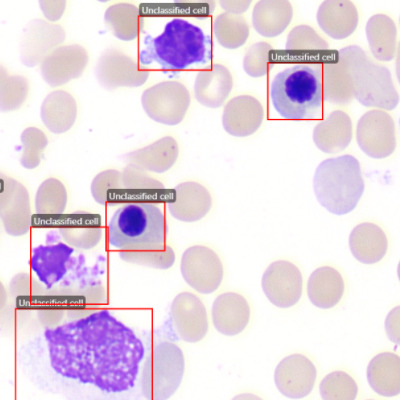 Bone Marrow Nucleated Cell