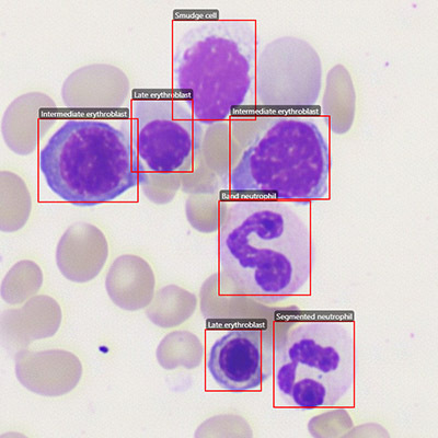 bone marrow nucleated cell