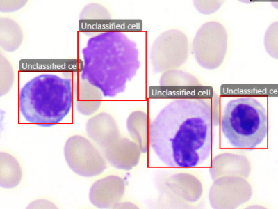 Bone Marrow Nucleated Cells