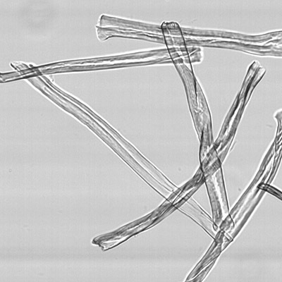 fibrillar component