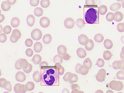 White Blood Cells