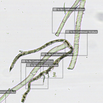 fibrillar component