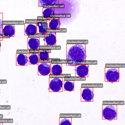 csf cell