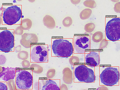 Bone Marrow Nucleated Cells
