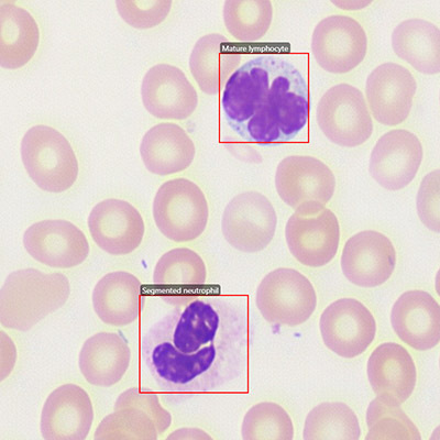 blood cell