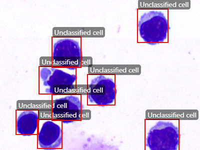 Cerebrospinal Fluid Nucleated Cells