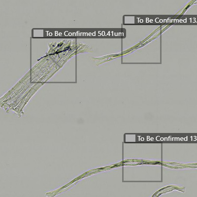 fibrillar component