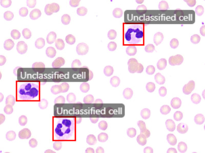 Blood Cells